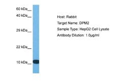 DPM2 Rabbit anti-Human, Polyclonal, Novus Biologicals 0.1ml; Unconjugated:Antibodies,